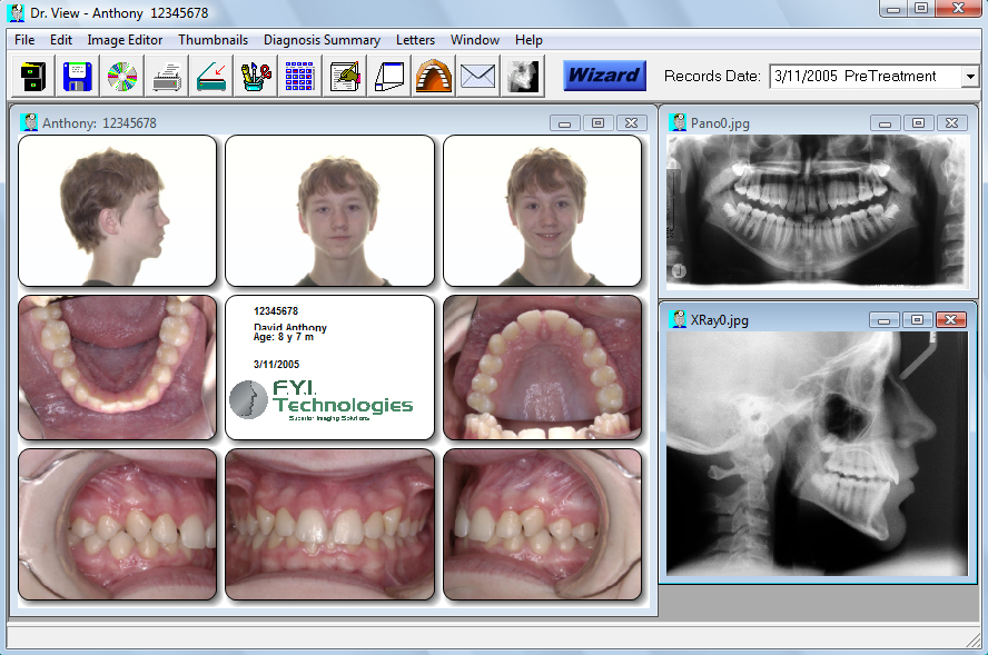 ortho extract software